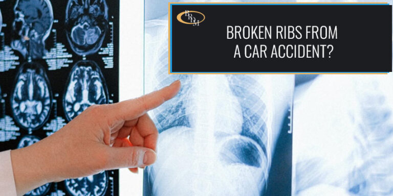 What Should I Do If I Have Broken Ribs from a Car Accident?